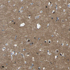 Anti-GPR158 Antibody