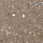 Anti-GPR158 Antibody