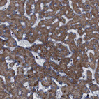 Anti-ATP7B Antibody