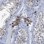Immunohistochemical staining of human Testis shows moderate granular cytoplasmic positivity in Leydig cells.