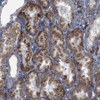 Immunohistochemical staining of human Kidney shows moderate granular cytoplasmic positivity in cells in tubules.