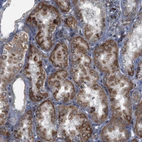 Immunohistochemical staining of human Kidney shows moderate granular cytoplasmic positivity in cells in tubules.