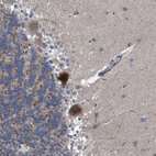 Immunohistochemical staining of human Cerebellum shows moderate granular cytoplasmic positivity in Purkinje cells.