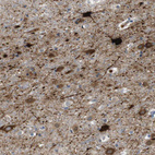 Anti-DCP1A Antibody
