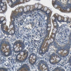 Immunohistochemical staining of human colon shows moderate cytoplasmic positivity in glandular cells.