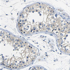 Immunohistochemical staining of human testis shows weak cytoplasmic positivity in cells in seminiferous ducts.