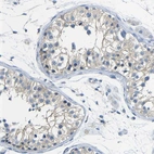 Immunohistochemical staining of human testis shows weak cytoplasmic positivity in cells in seminiferous ducts.