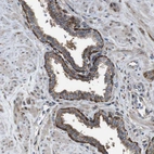 Immunohistochemical staining of human prostate shows strong cytoplasmic positivity in glandular cells.