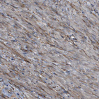 Immunohistochemical staining shows moderate cytoplasmic positivity in smooth muscle cells.