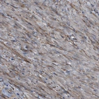 Immunohistochemical staining shows moderate cytoplasmic positivity in smooth muscle cells.
