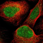 Immunofluorescent staining of human cell line U-2 OS shows localization to nucleoplasm & cytosol.