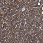 Anti-GGT7 Antibody