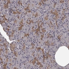 Anti-GPR78 Antibody