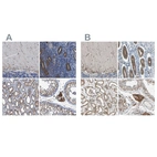 Anti-CLCC1 Antibody