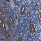 Immunohistochemical staining of human endometrium shows strong cytoplasmic positivity in glandular cells.