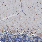 Immunohistochemical staining of human cerebellum shows weak positivity in neuronal processes.