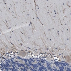 Immunohistochemical staining of human cerebellum shows weak positivity in neuronal processes.