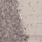 Anti-CDC14B Antibody