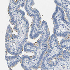 Immunohistochemical staining of human fallopian tube shows moderate positivity in cilia in glandular cells.