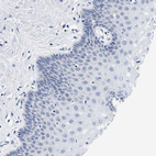 Immunohistochemical staining of human cervix, uterine shows no positivity in squamous epithelial cells as expected.