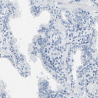 Anti-GP1BA Antibody