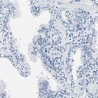 Immunohistochemical staining of human prostate shows no positivity in glandular cells as expected.