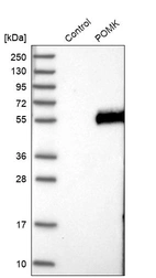 Western blot analysis in control (vector only transfected HEK293T lysate) and POMK over-expression lysate (Co-expressed with a C-terminal myc-DDK tag (~3.1 kDa) in mammalian HEK293T cells, LY410261).