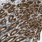 Immunohistochemical staining of human stomach shows strong cytoplasmic-nucleus positivity in glandular cells.