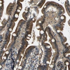 Immunohistochemical staining of human duodenum shows moderate cytoplasmic-nucleus positivity in glandular cells.