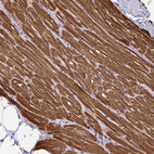 Immunohistochemical staining of human heart muscle shows strong cytoplasmic positivity in cardiomyocytes.
