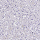 Anti-MYL7 Antibody