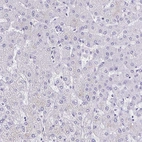 Immunohistochemical staining of human liver shows no positivity in hepatocytes as expected.