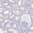 Anti-MYL7 Antibody