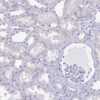 Immunohistochemical staining of human kidney shows no positivity in cells in tubules as expected.