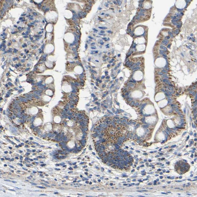 Anti-INTS6L Antibody