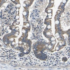 Anti-INTS6L Antibody