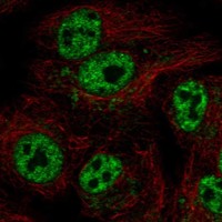 Anti-GTPBP6 Antibody