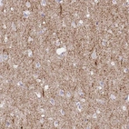 Immunohistochemical staining of human cerebral cortex shows moderate positivity in neuropil.