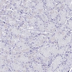 Immunohistochemical staining of human stomach shows no positivity in glandular cells as expected.