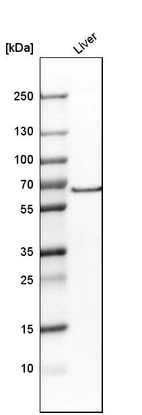 Western blot analysis in human liver tissue.