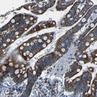Anti-WSCD2 Antibody