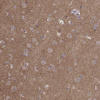 Anti-APC Antibody