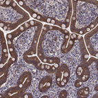 Immunohistochemical staining of human small intestine shows moderate to strong membranous and cytoplasmic positivity in glandular cells.