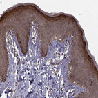 Immunohistochemical staining of human skin shows strong cytoplasmic positivity in squamous epithelial cells.