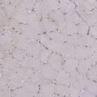 Immunohistochemical staining of human skeletal muscle shows low positivity in myocytes as expected.