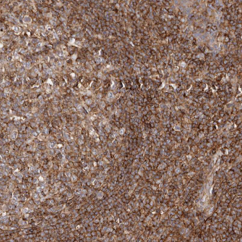 Anti-PTPN22 Antibody