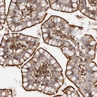 Immunohistochemical staining of human small intestine shows strong membranous positivity in glandular cells.