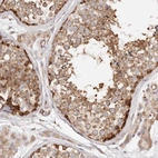 Immunohistochemical staining of human testis shows strong membranous positivity in cells in seminiferous ducts.