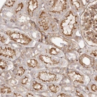 Immunohistochemical staining of human kidney shows strong membranous positivity in cells in tubules.