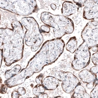 Immunohistochemical staining of human placenta shows strong cytoplasmic positivity in trophoblastic cells.